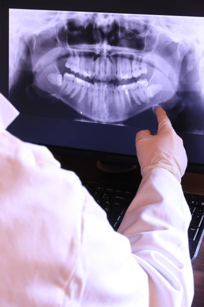 Best Emergency Root Canal Treatment in Vicksburg, MS